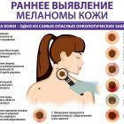 меланома ранее выявление.jpg