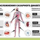 Осложнение СД.jpg